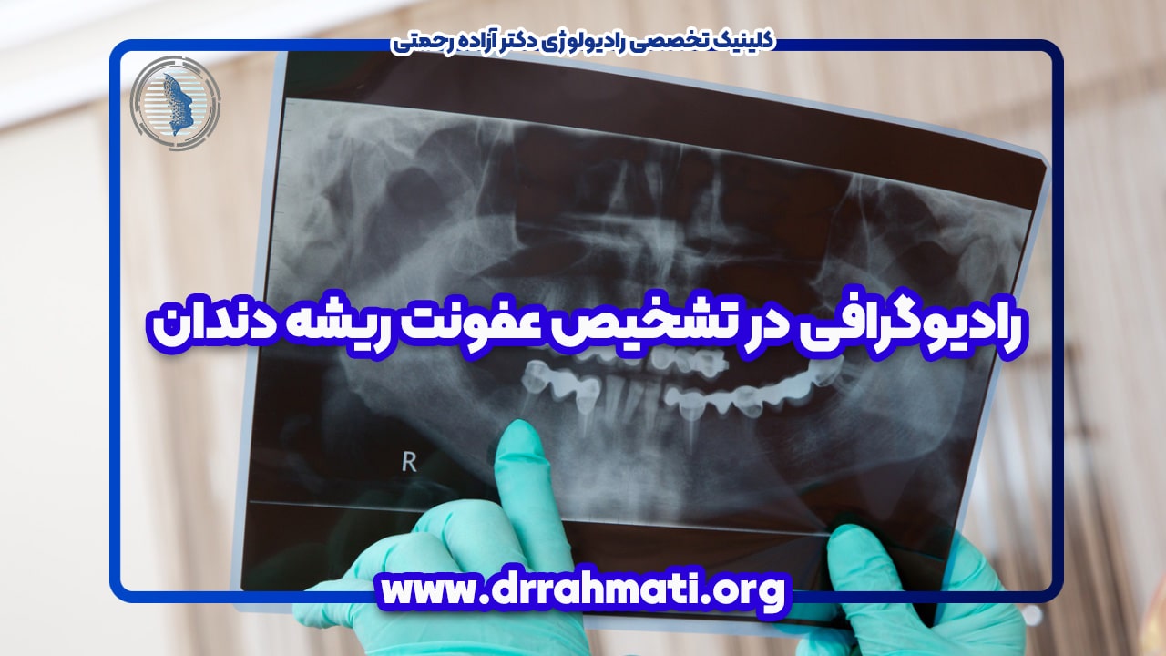 رادیوگرافی در تشخیص عفونت ریشه دندان - کلینیک دکتر آزاده رحمتی لاهیجان
