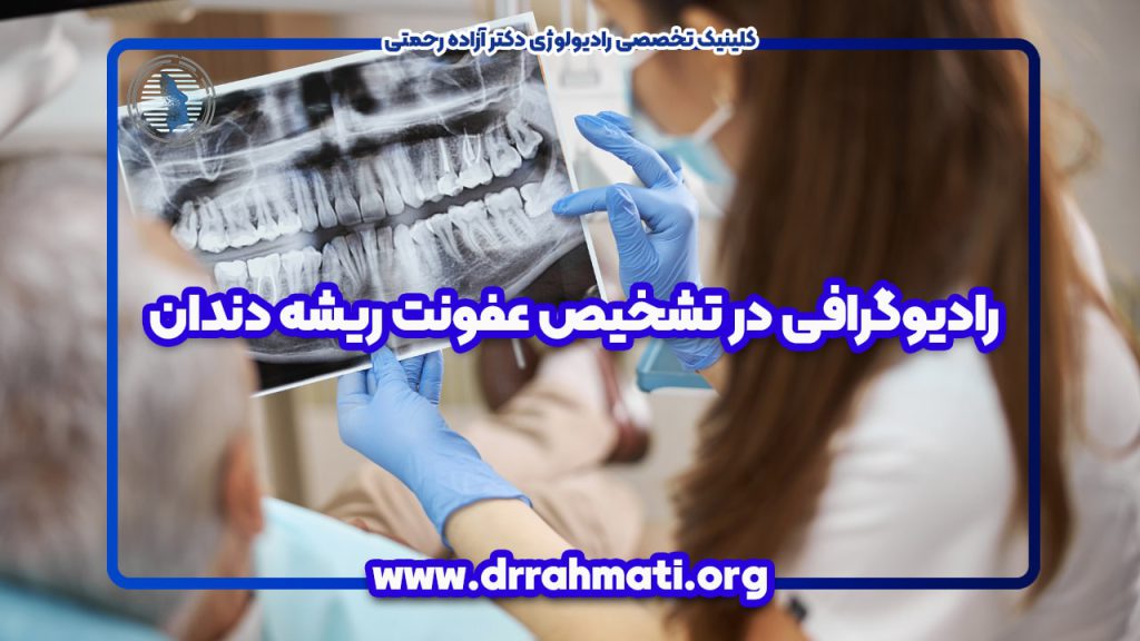رادیوگرافی در تشخیص عفونت ریشه دندان