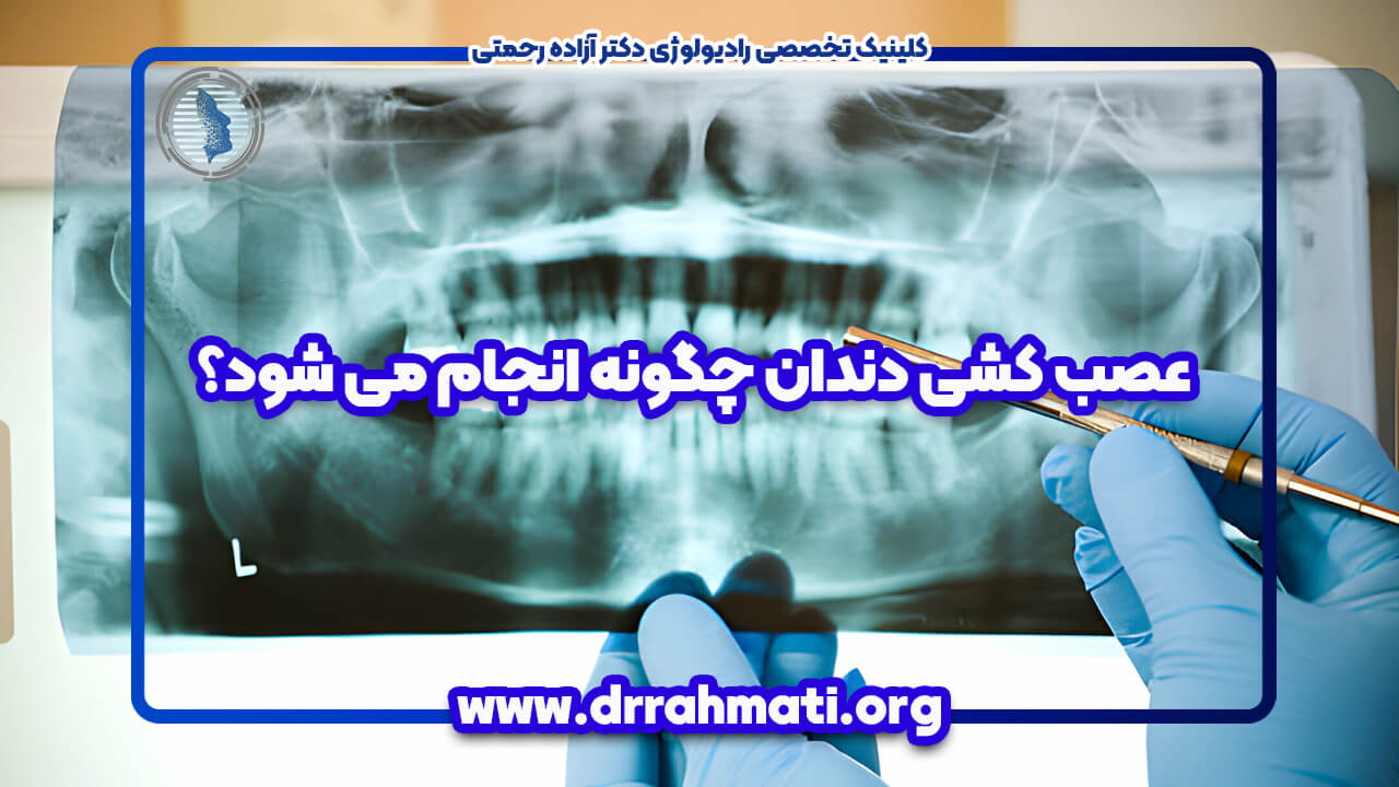 عصب کشی دندان چگونه انجام می شود؟ عکس برداری از دندان قبل از عصب کشی