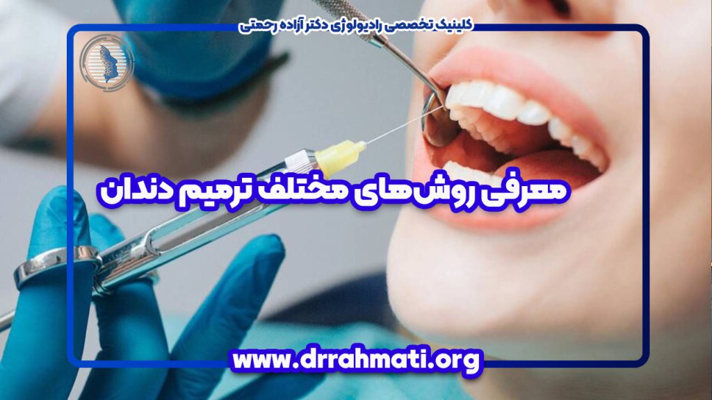 معرفی روش‌های مختلف ترمیم دندان