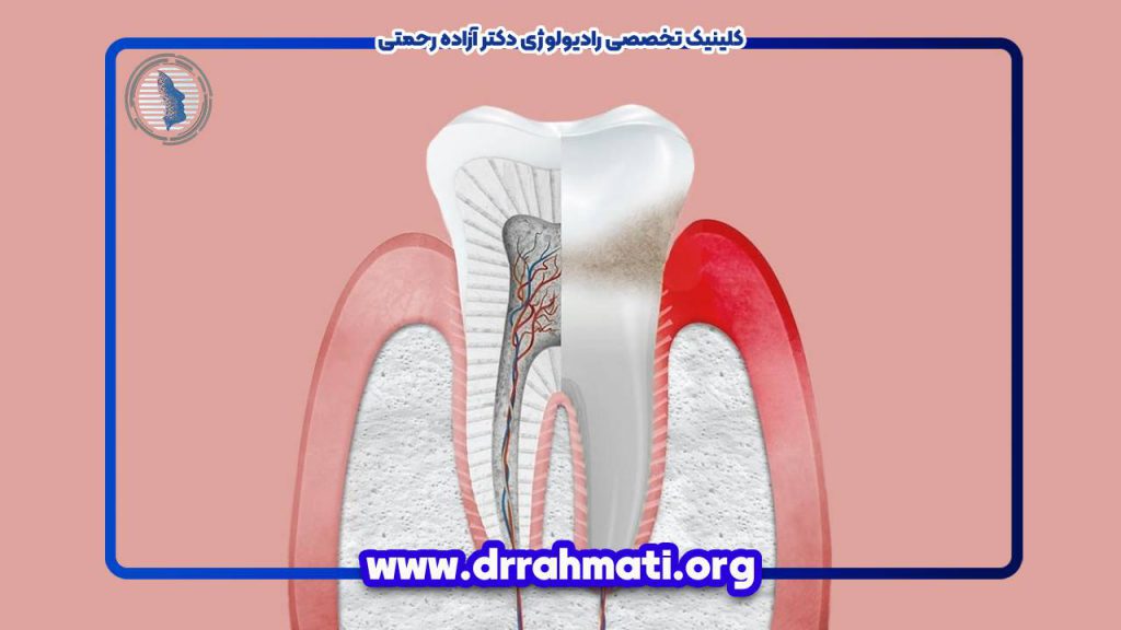 معرفی انواع آناتومی دندان و 6 جزء ساختار آن