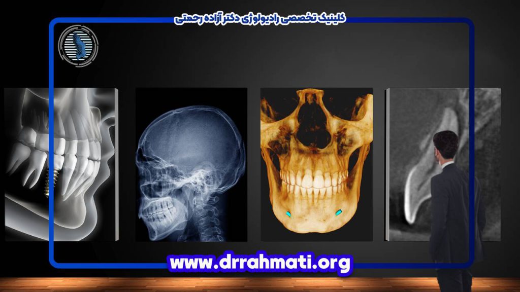 کاربرد MRI در جراحی فک و صورت