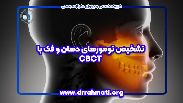 تشخیص تومورهای دهان و فک با CBCT