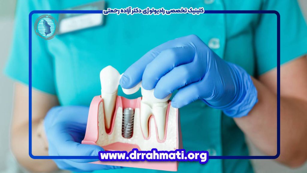 نقش رادیولوژی در برنامه ریزی ایمپلنت دندان