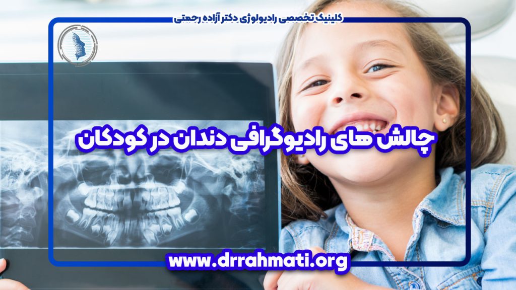 چالش های رادیوگرافی دندان در کودکان